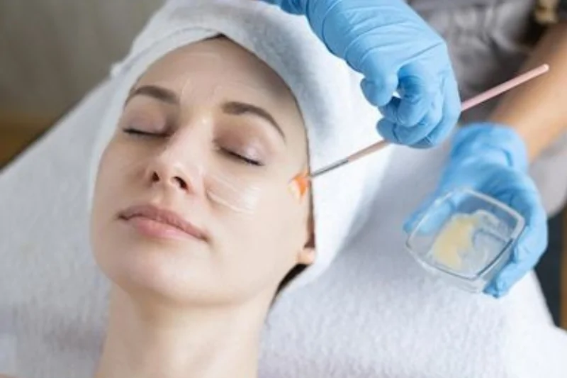 Peel da được xem là phương pháp làm đẹp được ưa chuộng nhất trong chăm sóc da 